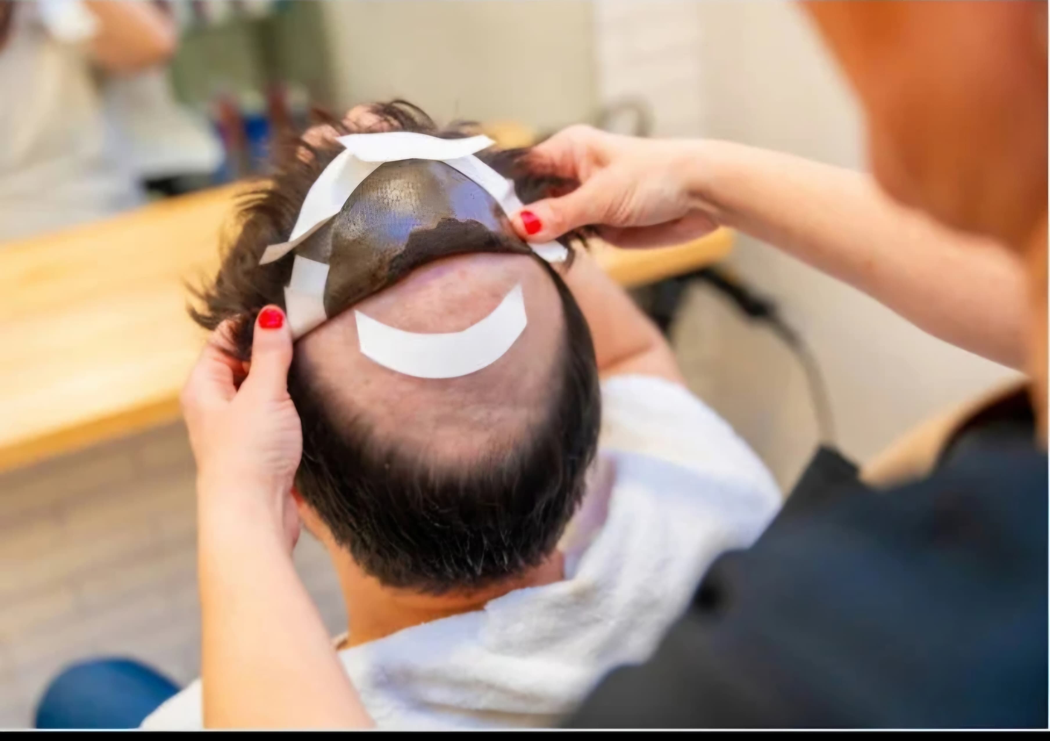 Hair Replacement Services